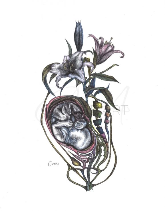 Intertwined