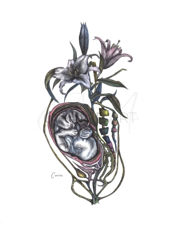 Intertwined