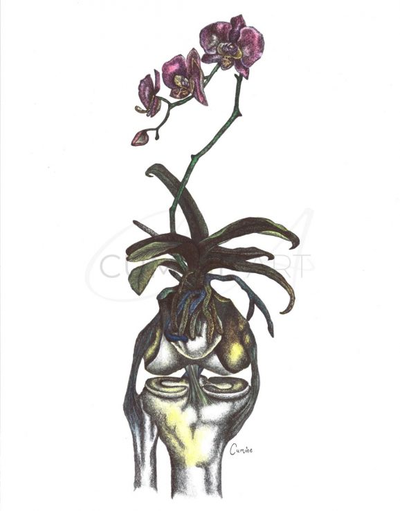 Reconstruction