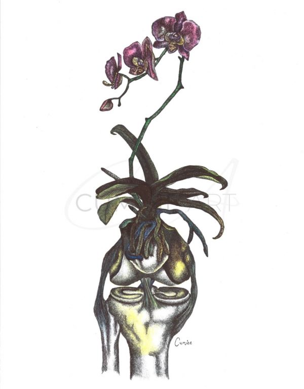 Reconstruction